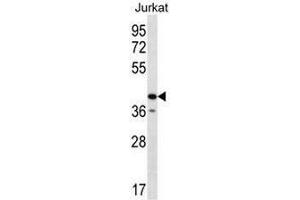 GORASP2 Antibody (Center) western blot analysis in Jurkat cell line lysates (35µg/lane). (GORASP2 anticorps  (Middle Region))