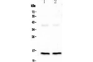 Western blot analysis of Cardiac FABP using anti-Cardiac FABP antibody .