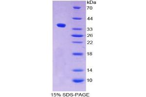 SDS-PAGE analysis of Human ALPPL2 Protein.