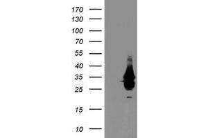 Western Blotting (WB) image for anti-Single-Stranded DNA Binding Protein 1 (SSBP1) antibody (ABIN1499909) (SSBP1 anticorps)