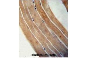 EFTUD1 antibody (C-term) (ABIN654331 and ABIN2844107) immunohistochemistry analysis in formalin fixed and paraffin embedded human skeletal muscle followed by peroxidase conjugation of the secondary antibody and DAB staining.