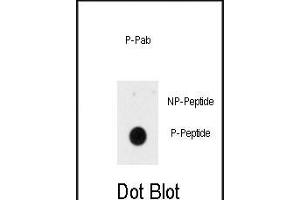 Dot blot analysis of anti-Phospho-INSR-p Antibody (ABIN389937 and ABIN2839751) on nitrocellulose membrane. (Insulin Receptor anticorps  (pTyr1185))
