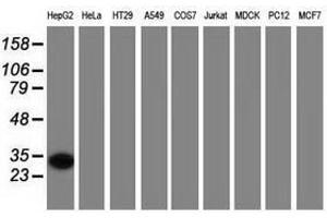 Image no. 2 for anti-Sulfotransferase Family, Cytosolic, 2A, Dehydroepiandrosterone (DHEA)-Preferring, Member 1 (SULT2A1) antibody (ABIN1501238) (SULT2A1 anticorps)