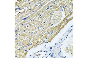 Immunohistochemistry of paraffin-embedded mouse heart using SLC5A6 antibody (ABIN6292573) at dilution of 1:100 (40x lens).
