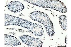 IHC analysis of MCM6 using anti-MCM6 antibody (ABIN7600038).