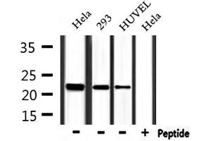 Western blot analysis of extracts from Hela,293 and HUVEC, using FTH1 Antibody.