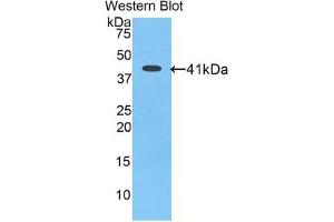 Western blot analysis of the recombinant protein. (Angiotensin III anticorps  (AA 33-145))