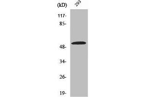 Western Blot analysis of COLO205 cells using ZIP7 Polyclonal Antibody (SLC39A7 anticorps  (Internal Region))