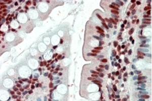 Immunohistochemistry (IHC) image for anti-Ewing Sarcoma Breakpoint Region 1 (EWSR1) antibody (ABIN5864986) (EWSR1 anticorps)