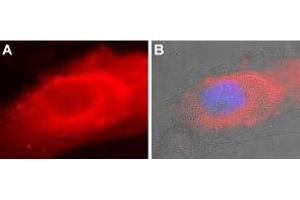 Expression of SERCA2 in mouse C2C12 cells - Immunocytochemical staining of fixed and permeabilized mouse myoblast C2C12 cells.