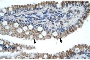 Human Intestine (ZNF683 anticorps  (N-Term))