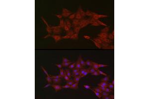 Immunofluorescence analysis of PC-12 cells using KPNB1 Rabbit pAb (ABIN6134722, ABIN6142997, ABIN6142998 and ABIN6224723) at dilution of 1:100 (40x lens). (KPNB1 anticorps  (AA 250-350))