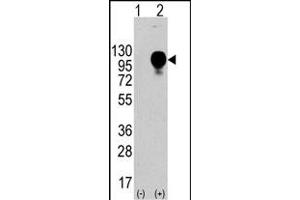 Western blot analysis of LP2 (arrow) using LP2 Antibody (Center) (ABIN388569 and ABIN2849749).