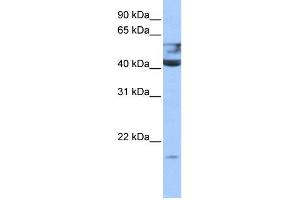 WB Suggested Anti-QTRT1 Antibody Titration:  0. (QTRT1 anticorps  (N-Term))