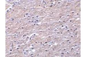 Immunohistochemistry of Clusterin in human brain tissue with Clusterin antibody at 10 μg/ml. (Clusterin anticorps  (Isoform 1))