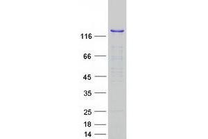Validation with Western Blot
