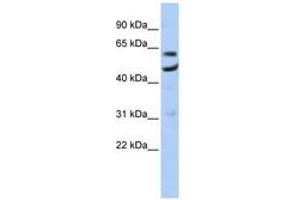 Image no. 1 for anti-CCR4-NOT Transcription Complex, Subunit 6 (CNOT6) (AA 35-84) antibody (ABIN6740696) (CNOT6 anticorps  (AA 35-84))