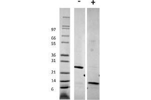 SDS-PAGE of Human Growth and Differentiation Factor-5 Recombinant Protein SDS-PAGE of Human Growth and Differentiation Factor-5 Recombinant Protein. (GDF5 Protéine)