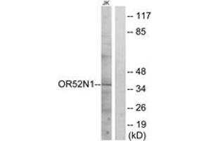 Western blot analysis of extracts from Jurkat cells, using OR52N1 Antibody. (OR52N1 anticorps  (AA 269-318))