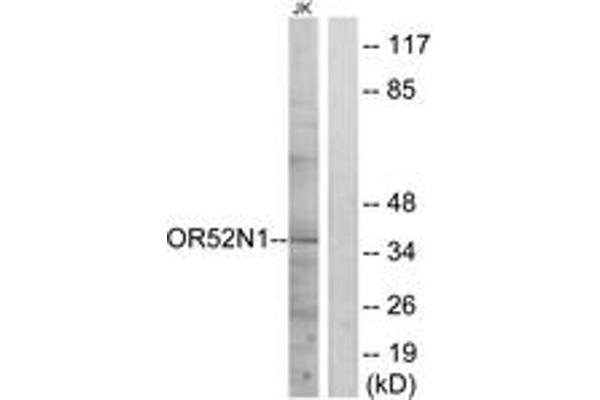 OR52N1 anticorps  (AA 269-318)