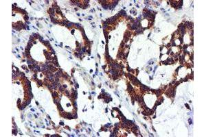 Image no. 5 for anti-NADH Dehydrogenase (Ubiquinone) 1 beta Subcomplex, 9, 22kDa (NDUFB9) (AA 3-179) antibody (ABIN1491359)