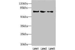 Western blot All lanes: PPIL4 antibody at 4 μg/mL Lane 1: Hela whole cell lysate Lane 2: Mouse kidney tissue Lane 3: HepG2 whole cell lysate Secondary Goat polyclonal to rabbit IgG at 1/10000 dilution Predicted band size: 58 kDa Observed band size: 70 kDa (PPIL4 anticorps  (AA 1-492))