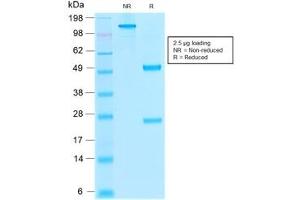 SDS-PAGE analysis of purified, BSA-free recombinant Thrombomodulin antibody (clone rTHBD/1591) as confirmation of integrity and purity. (Thrombomodulin anticorps  (AA 69-194))