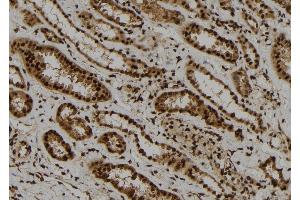 ABIN6278352 at 1/100 staining Human kidney tissue by IHC-P. (ARL4A anticorps  (Internal Region))