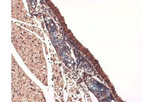 Immunohistochemistry analysis using Mouse Anti-Sodium Iodide Symporter Monoclonal Antibody, Clone 14F .