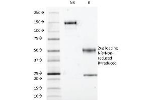 SDS-PAGE Analysis S100B Mouse Monoclonal Antibody (S100B/1012). (S100B anticorps)