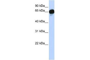 WB Suggested Anti-DGKE Antibody Titration:  0. (DGKE anticorps  (N-Term))