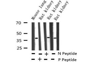 Western blot analysis of Phospho-c-Jun (Tyr170) expression in various lysates