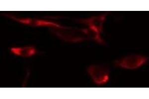 ABIN6275441 staining  NIH-3T3 cells by IF/ICC.
