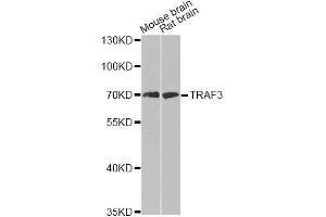 Western blot analysis of extracts of various cell lines, using TRAF3 antibody (ABIN6292132) at 1:500 dilution.
