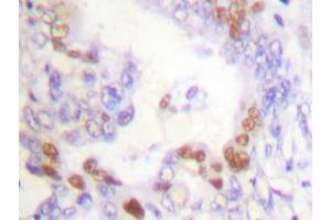 Image no. 1 for anti-Fanconi Anemia, Complementation Group D2 (FANCD2) antibody (ABIN265413) (FANCD2 anticorps)