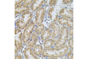Immunohistochemistry of paraffin-embedded rat kidney using MMP10 antibody (ABIN5971553) at dilution of 1/100 (40x lens).