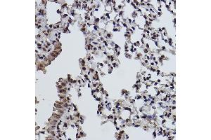 Immunohistochemistry of paraffin-embedded mouse lung using MonoMethyl-Histone H3-K9 antibody (ABIN7267685) at dilution of 1:100 (40x lens). (Histone 3 anticorps  (H3K9me))