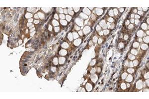 ABIN6267378 at 1/100 staining Rat colon tissue by IHC-P.