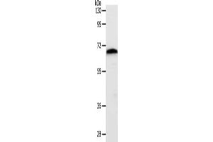 Gel: 10 % SDS-PAGE, Lysate: 40 μg, Lane: Mouse liver tissue, Primary antibody: ABIN7192428(SLC22A3 Antibody) at dilution 1/400, Secondary antibody: Goat anti rabbit IgG at 1/8000 dilution, Exposure time: 1 minute (SLC22A3 anticorps)