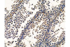 anti-Acid Phosphatase 1, Soluble (ACP1) antibody