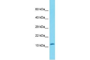 Host: Rabbit Target Name: DEFB119 Sample Type: Fetal Heart lysates Antibody Dilution: 1. (DEFB119 anticorps  (N-Term))