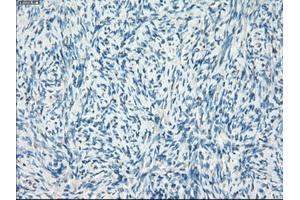 Immunohistochemical staining of paraffin-embedded colon tissue using anti-LTA4H mouse monoclonal antibody. (LTA4H anticorps)