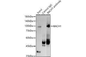 Immunoprecipitation analysis of 300 μg extracts of K-562 cells using 3 μg B antibody (ABIN7265956).