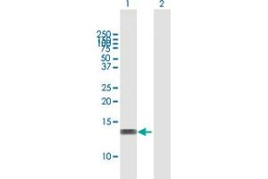 Western Blot analysis of RBBP6 expression in transfected 293T cell line by RBBP6 MaxPab polyclonal antibody. (RBBP6 anticorps  (AA 1-118))