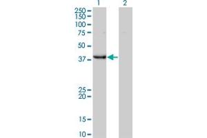 Western Blot analysis of UROD expression in transfected 293T cell line by UROD monoclonal antibody (M01A), clone 1G4. (UROD anticorps  (AA 268-367))