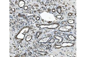 IHC analysis of METTL1 using anti-METTL1 antibody (ABIN7600484).