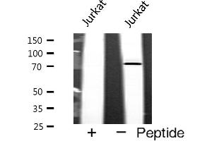 Western blot analysis of p73 expression in Jurkat cells (Tumor Protein p73 anticorps)