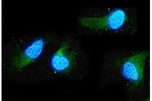 IF analysis of ADO using anti-ADO antibody (ABIN4886431). (ADO anticorps  (AA 49-261))