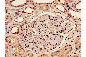 Immunohistochemistry of paraffin-embedded human kidney tissue using ABIN7145684 at dilution of 1:100