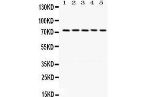 Western Blotting (WB) image for anti-LIM Domain Kinase 1 (LIMK1) (AA 599-634), (C-Term) antibody (ABIN3043411) (LIM Domain Kinase 1 anticorps  (C-Term))